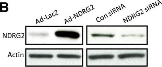 NDRG2 Antibody (6A5)