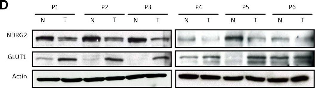 NDRG2 Antibody (6A5)