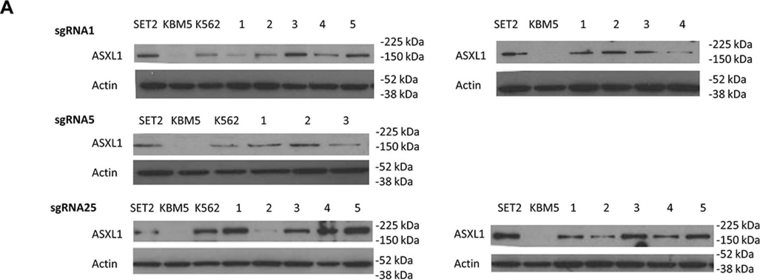 ASXL1 Antibody (6E2)