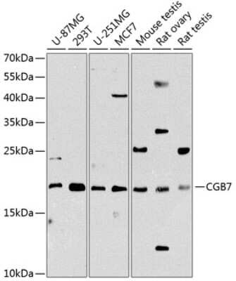 Western Blot: hCG beta 7 AntibodyBSA Free [NBP3-03574]