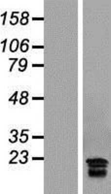 Western Blot: hCG beta 7 Overexpression Lysate [NBL1-09132]