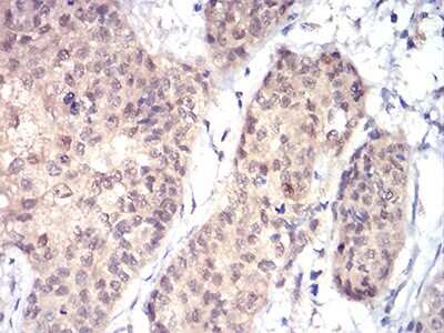 Immunohistochemistry-Paraffin: Rad23 Antibody (3E3F4) - BSA Free [NBP2-52549]