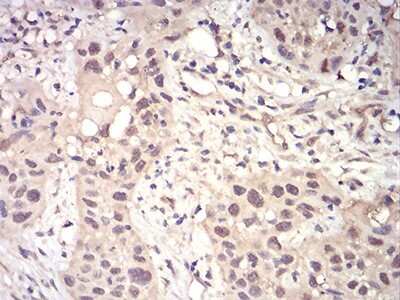 Immunohistochemistry-Paraffin: Rad23 Antibody (3E3F4) - BSA Free [NBP2-52549]