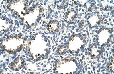 Immunohistochemistry-Paraffin: Rad23 Antibody [NBP1-52920]