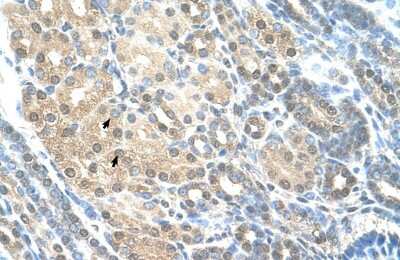 Immunohistochemistry-Paraffin: Rad23 Antibody [NBP1-52942]