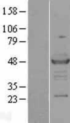 Western Blot: Rad23 Overexpression Lysate [NBP2-10521]