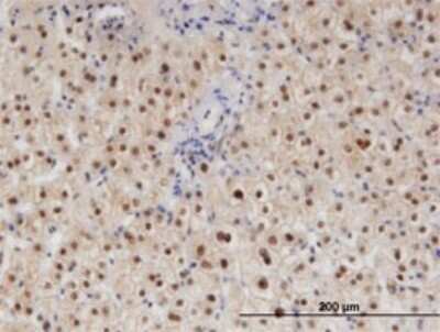Immunohistochemistry-Paraffin: hHR23b Antibody (3H7) [H00005887-M10]