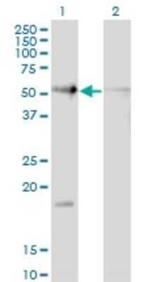 Western Blot: hHR23b Antibody (3H7) [H00005887-M10]