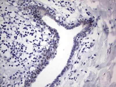 Immunohistochemistry: hHR23b Antibody (OTI7G10) [NBP2-45514]