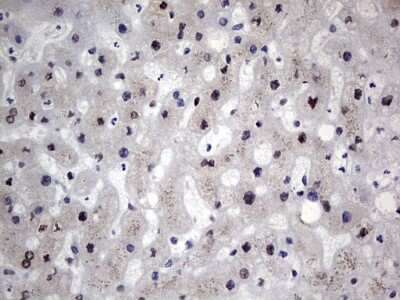 Immunohistochemistry: hHR23b Antibody (OTI7G10) [NBP2-45514]