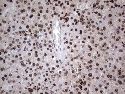 Immunohistochemistry: hHR23b Antibody (OTI7G10) [NBP2-45514]