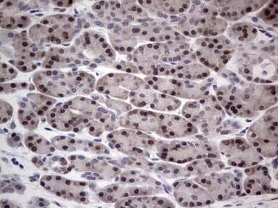 Immunohistochemistry: hHR23b Antibody (OTI7G10) [NBP2-45514]