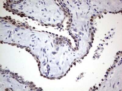 Immunohistochemistry: hHR23b Antibody (OTI7G10) [NBP2-45514]