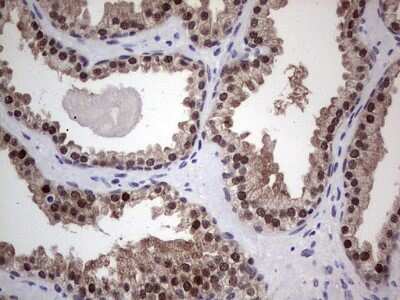 Immunohistochemistry: hHR23b Antibody (OTI7G10) [NBP2-45514]