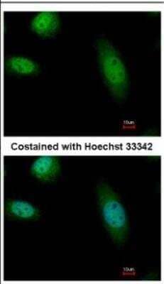 Immunocytochemistry/ Immunofluorescence: hHR23b Antibody [NBP2-16825]