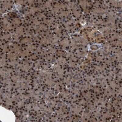 Immunohistochemistry-Paraffin: hHR23b Antibody [NBP1-89698]