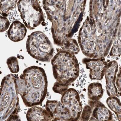 Immunohistochemistry-Paraffin: hHR23b Antibody [NBP1-89698]