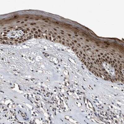 Immunohistochemistry-Paraffin: hHR23b Antibody [NBP1-89698]