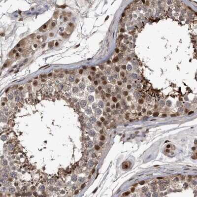Immunohistochemistry-Paraffin: hHR23b Antibody [NBP1-89698]