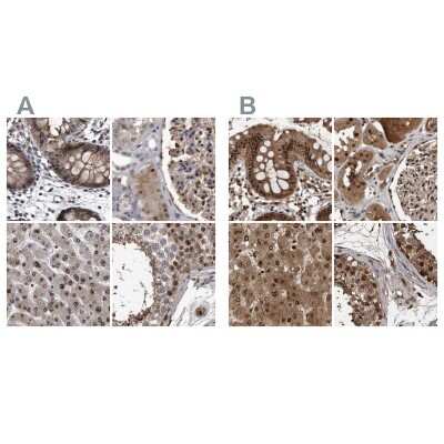 Immunohistochemistry-Paraffin: hHR23b Antibody [NBP1-89698]