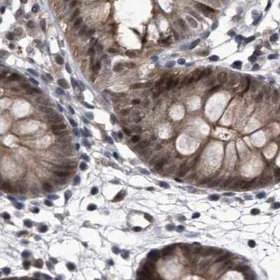 Immunohistochemistry-Paraffin: hHR23b Antibody [NBP1-89698]