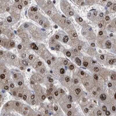 Immunohistochemistry-Paraffin: hHR23b Antibody [NBP1-89698]