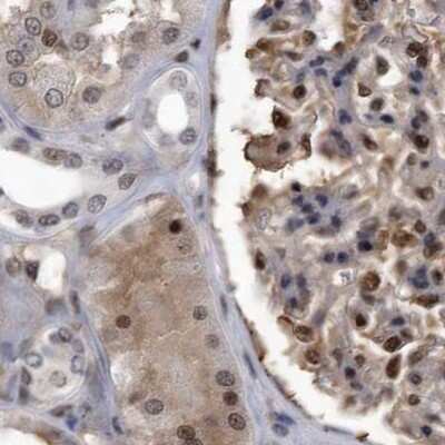 Immunohistochemistry-Paraffin: hHR23b Antibody [NBP1-89698]