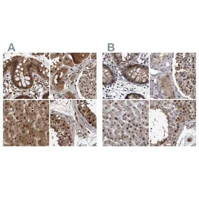 Immunohistochemistry-Paraffin: hHR23b Antibody [NBP1-89699]