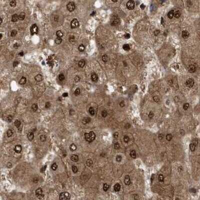 Immunohistochemistry-Paraffin: hHR23b Antibody [NBP1-89699]