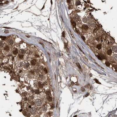 Immunohistochemistry-Paraffin: hHR23b Antibody [NBP1-89699]