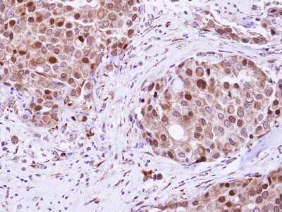 Immunohistochemistry-Paraffin: hHR23b Antibody [NBP2-16825]