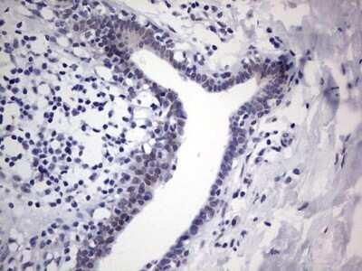 Immunohistochemistry: hHR23b Antibody (OTI7G10) - Azide and BSA Free [NBP2-71269]