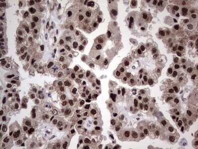 Immunohistochemistry: hHR23b Antibody (OTI7G10) - Azide and BSA Free [NBP2-71269]