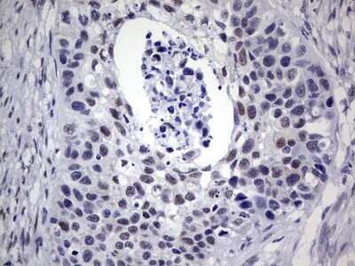 Immunohistochemistry: hHR23b Antibody (OTI7G10) - Azide and BSA Free [NBP2-71269]