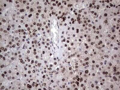 Immunohistochemistry: hHR23b Antibody (OTI7G10) - Azide and BSA Free [NBP2-71269]