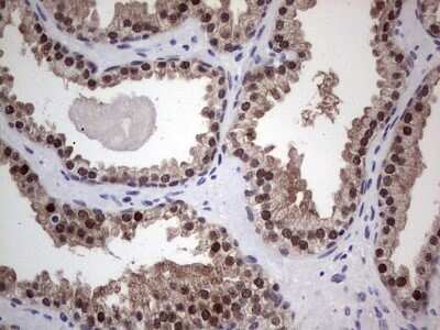 Immunohistochemistry: hHR23b Antibody (OTI7G10) - Azide and BSA Free [NBP2-71269]
