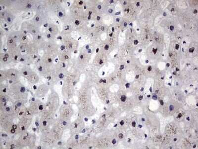 Immunohistochemistry: hHR23b Antibody (OTI7G10) - Azide and BSA Free [NBP2-71269]