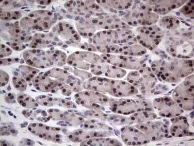 Immunohistochemistry: hHR23b Antibody (OTI7G10) - Azide and BSA Free [NBP2-71269]