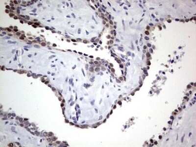 Immunohistochemistry: hHR23b Antibody (OTI7G10) - Azide and BSA Free [NBP2-71269]