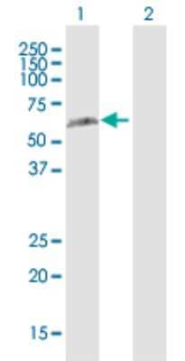 Western Blot: hHR23b Antibody [H00005887-D02P]