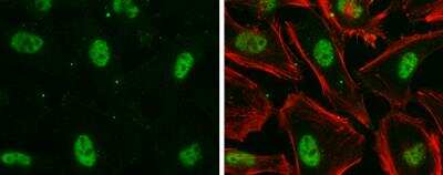 Immunocytochemistry/ Immunofluorescence: hHpr1-p84-Thoc1 Antibody (5E10) [NB100-174]