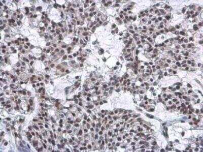Immunohistochemistry-Paraffin: hHpr1-p84-Thoc1 Antibody (5E10) [NB100-174]
