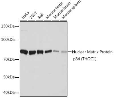 Western Blot: hHpr1-p84-Thoc1 Antibody (6E3A7) [NBP3-16800]