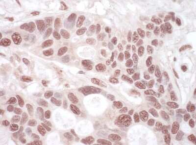 Immunohistochemistry-Paraffin: hHpr1-p84-Thoc1 Antibody [NBP1-47304]