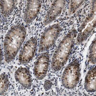 Immunohistochemistry-Paraffin: hHpr1-p84-Thoc1 Antibody [NBP1-89669]