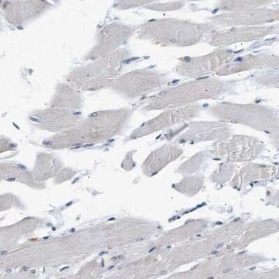 Immunohistochemistry-Paraffin: hHpr1-p84-Thoc1 Antibody [NBP1-89669]