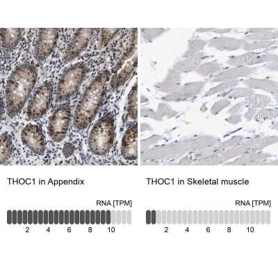 Immunohistochemistry-Paraffin: hHpr1-p84-Thoc1 Antibody [NBP1-89669]