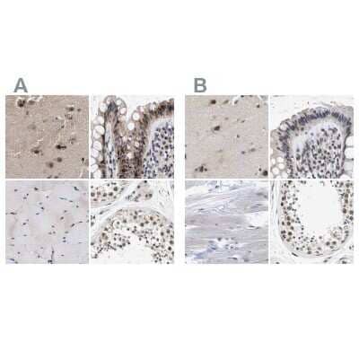 Immunohistochemistry-Paraffin: hHpr1-p84-Thoc1 Antibody [NBP1-89669]