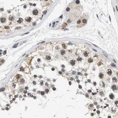Immunohistochemistry-Paraffin: hHpr1-p84-Thoc1 Antibody [NBP1-89669]