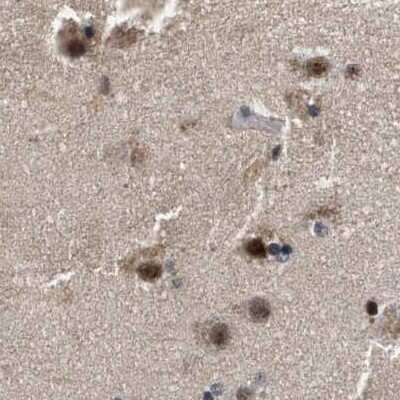 Immunohistochemistry-Paraffin: hHpr1-p84-Thoc1 Antibody [NBP1-89669]